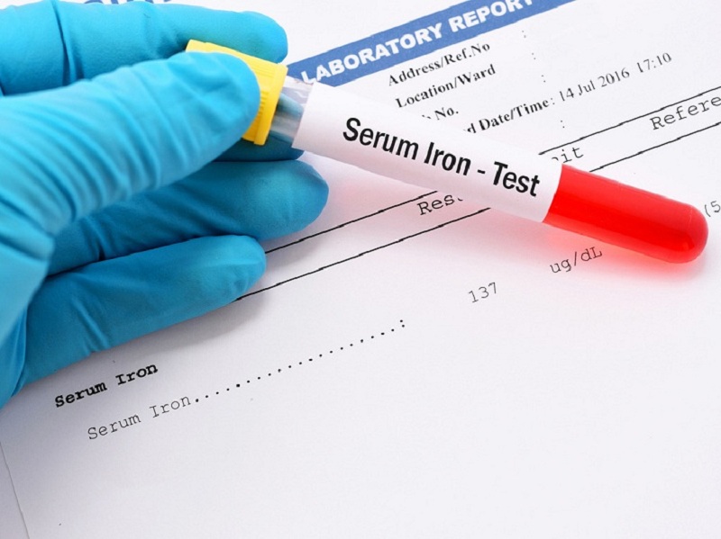 Xét Nghiệm Sắt Huyết Thanh và Ferritin: Ý Nghĩa, Khi Nào Cần Làm và Lưu Ý