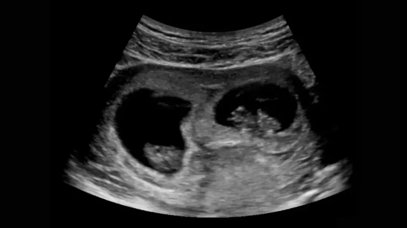 Có Bầu Mấy Tháng Thì Uống Sắt Hợp Lý & An Toàn Cho Mẹ Bầu