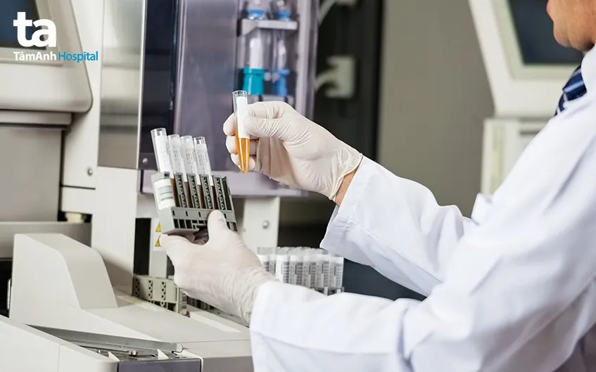 chẩn đoán tiểu ra máu