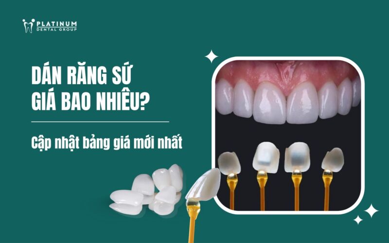 Giá Cá Trê Đen Hôm Nay: Chi Tiết Cập Nhật Và Yếu Tố Ảnh Hưởng