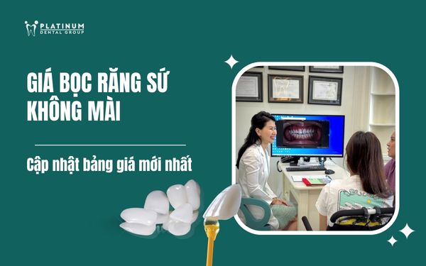 Giá Sắt Cây Phi 16 Tốt Nhất: Báo Giá Cập Nhật & Nhà Cung Cấp Uy Tín