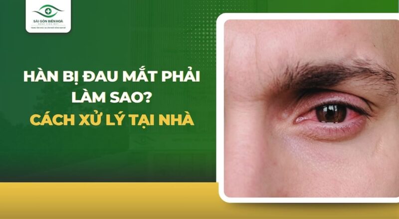 Hàn Sắt Bị Đau Mắt Phải Làm Sao Hướng Dẫn Bảo Vệ Và Chữa Trị