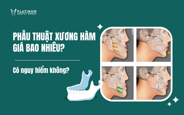 Hướng Dẫn Kỹ Thuật Trồng Chanh Dây Toàn Diện Từ A-Z