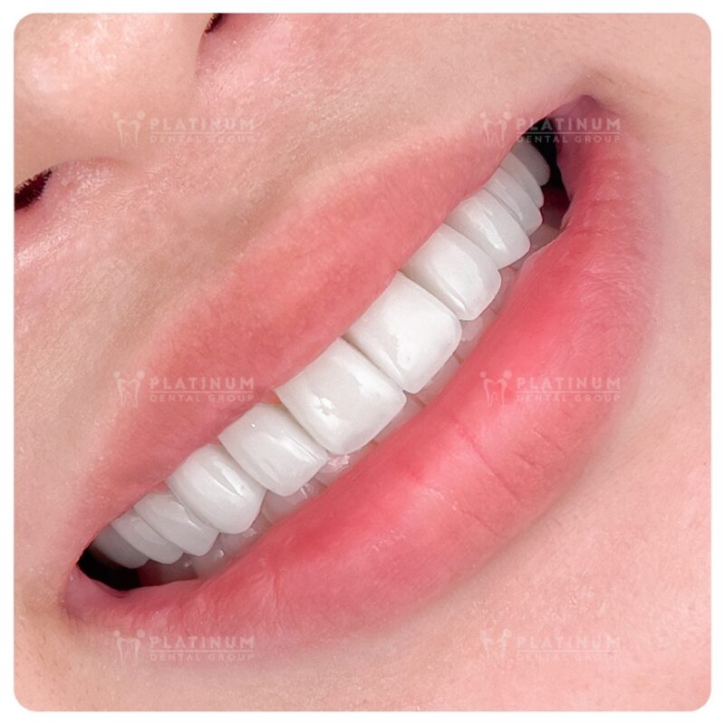 Chi Phí Đổ Bê Tông Sàn: Yếu Tố Ảnh Hưởng, Báo Giá Chi Tiết & Giải Pháp Tối Ưu