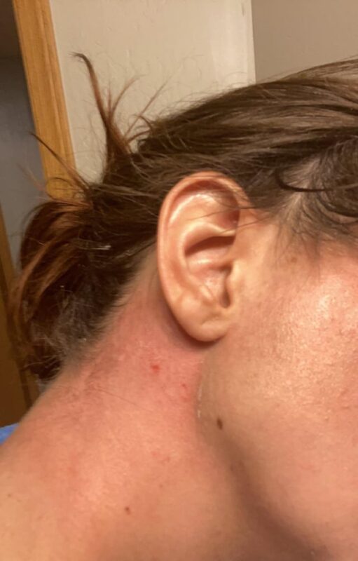 Tìm Hiểu Kỹ Lưỡng: Thuốc Sắt Cho Bà Bầu Loại Nào Tốt Nhất Hiện Nay?