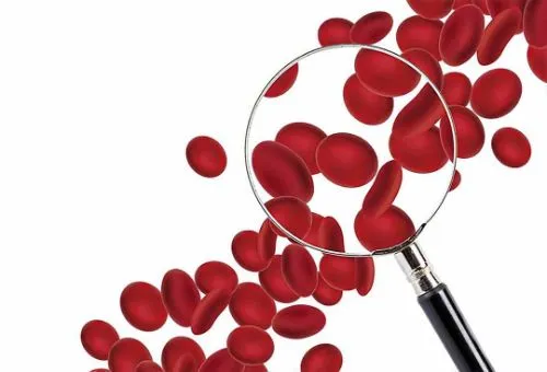 Tình trạng thiếu máu ở sản phụ sau sinh