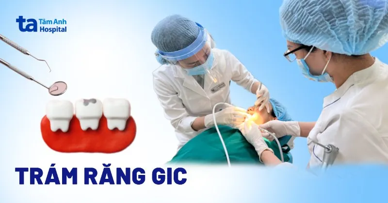trám răng GIC