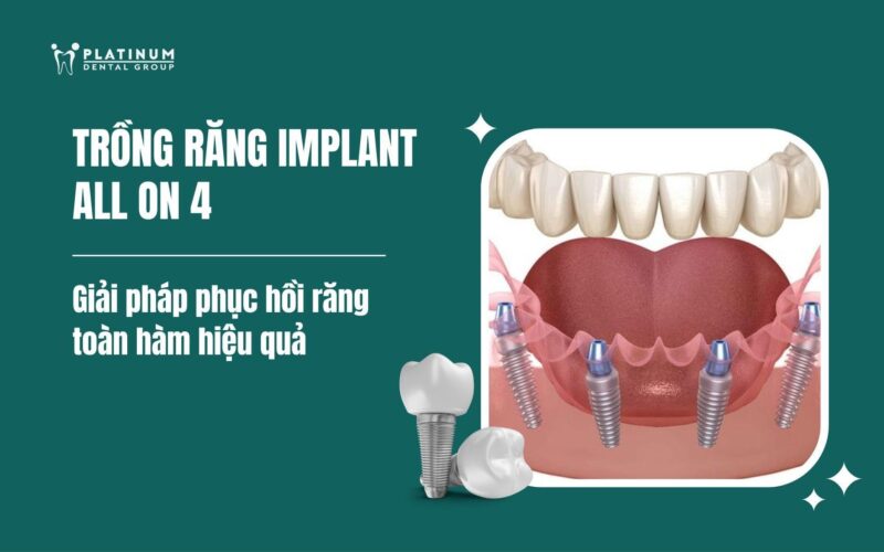 Toàn Diện Kỹ Thuật Trồng Chanh Dây Đạt Năng Suất Cao