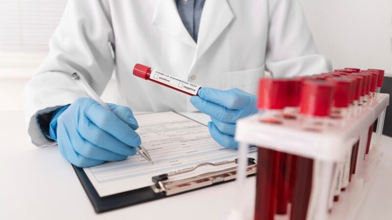 Xét Nghiệm Sắt Huyết Thanh và Ferritin: Ý Nghĩa, Khi Nào Cần Làm và Lưu Ý